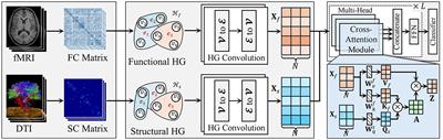 A hypergraph transformer method for brain disease diagnosis